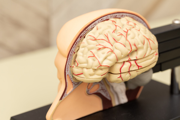 認知症の原因となる脳疾患